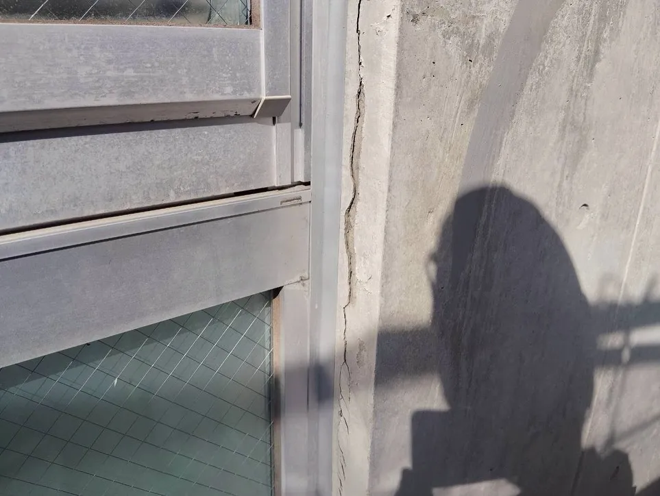 欠損補修を行いました✨